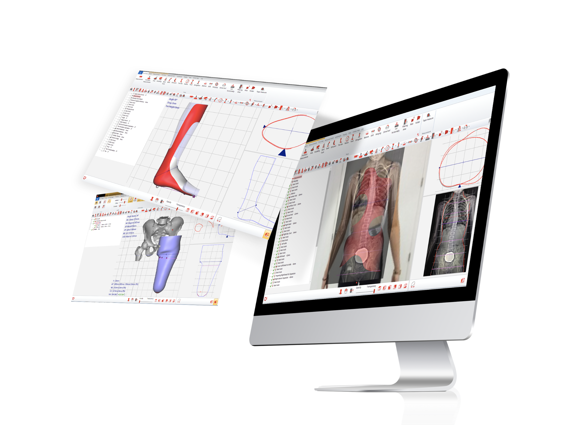 cad-cam voor orthopedie